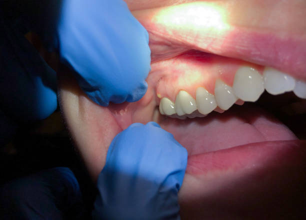 Best Pediatric Emergency Dentist in Kenmore, NY